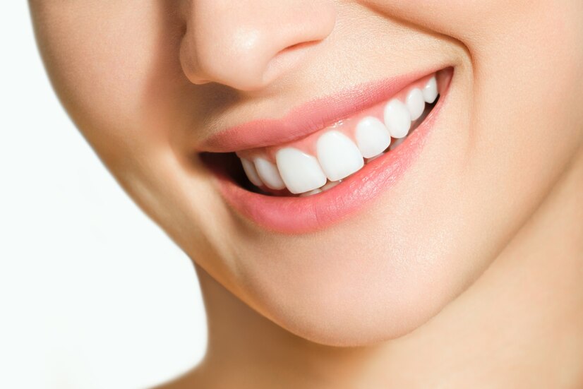 eeth Whitening treatment