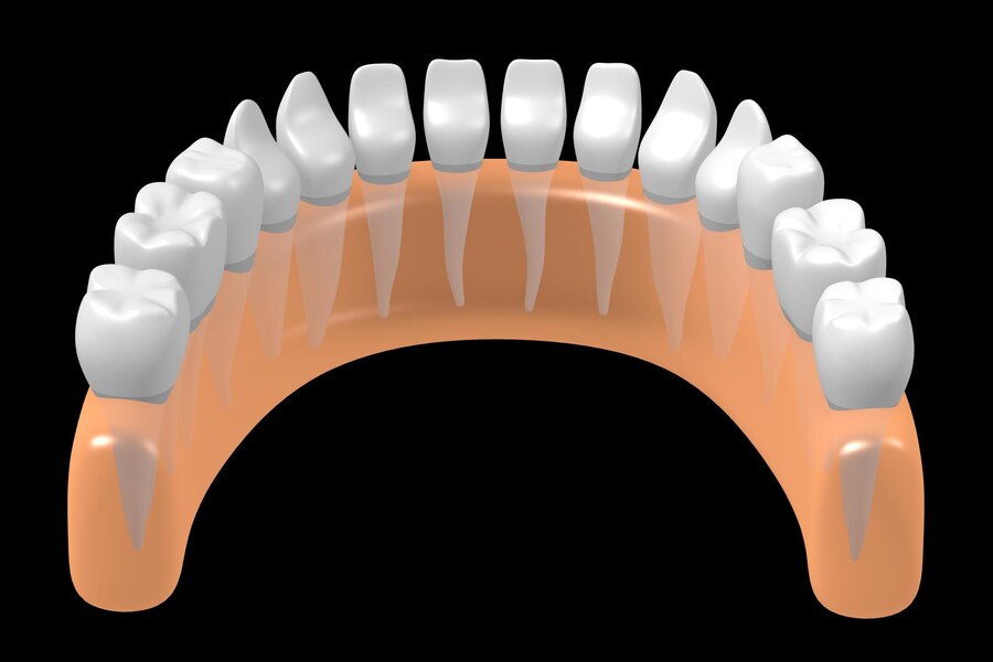 The Evolution Of Crown And Bridge Techniques In Dentistry